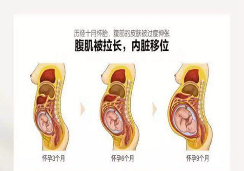 子宫的神秘 收缩力 ,把内脏挤成了这样,十月怀胎备受煎熬