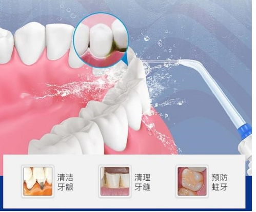 冲牙器的危害和副作用汇总 口腔师警告4大风险