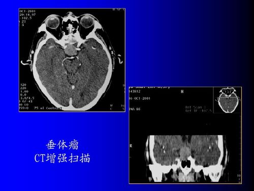 为何医生很多时候不建议做核磁共振 也许看完这篇本文你就明白了