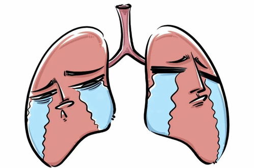 女性严重的肺病可能与不良情绪有关