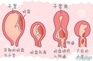 坐月子这9件事照做别嫌烦,尤其第八条,不然大肚相伴留下后遗症