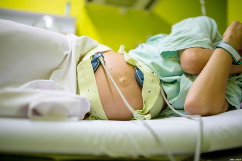 孕妇能做核磁共振吗