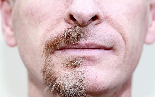 男性寿命和刮胡子的频率有关吗 胡子长得快说明啥 看完涨知识了