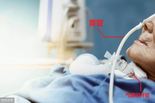 胆小勿入 你们的亲人送入ICU,都会受到哪些 酷刑