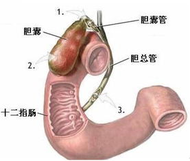 胆囊息肉是什么引起的(胆囊息肉是什么原因引起的呢)