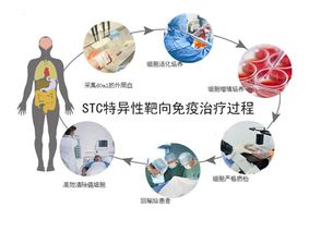 STC细胞免疫治疗可重振免疫细胞活力