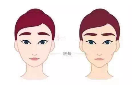 王明利 面部凹陷的女人更显老