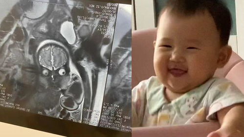 宝妈突然翻出孕37周核磁共振片子,宝宝瞪眼搞怪又惊悚 差点笑晕