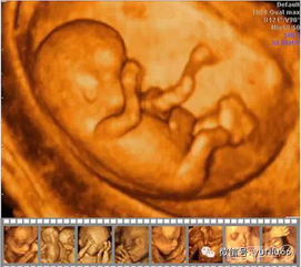 原创四维彩超真的能看出胎儿的性别吗？做四维彩超要注意什么？