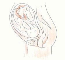 怀孕九个月男胎儿图，9个月真实胎儿图片欣赏