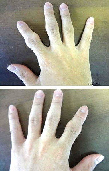 手指三个关节图