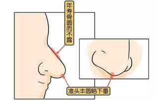 拥有这种鼻子的人天生 吸 金,想不发家都难 