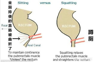 为什么蹲马桶不习惯 每次都要四十分钟这样 