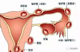 导致宫外孕的9个原因,你都知道吗