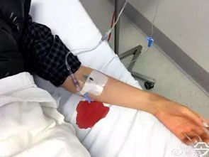 澳洲少女在中国受伤回澳治疗,遭遇医疗事故左手拇指变脚趾
