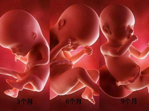 9个月真实胎儿图片欣赏