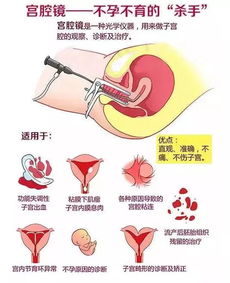 你还怕做宫腔镜吗 怕是想太多了 