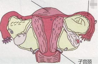 宫颈癌 唯一可防 可治的妇科恶性肿瘤 我院妇产科副主任医师刘莹谈宫颈癌防治