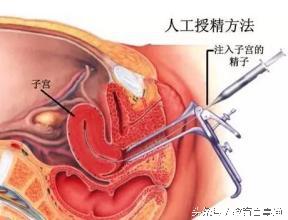 人工授精和试管婴儿有什么区别(做人工授精女方痛苦吗)