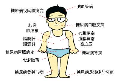 从教33年的教师，患糖尿病、腰间盘突出等病，可以提前退休吗(教师得了腰间盘突出可以请假吗)