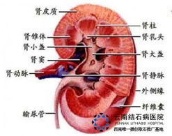 男性肾结石1.1影响性功能吗