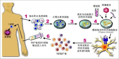 免疫治疗真的可以治愈癌症吗 浅谈免疫治疗的原理和应用