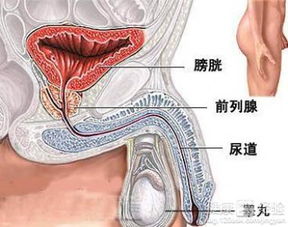 膀胱癌复发还需手术吗