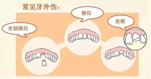 小伙吃烤全羊牙齿竟然崩掉一块,置之不理结果麻烦来了,悔不当初