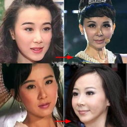 李小璐林心如倪妮皱纹明显变沧桑 女星装嫩遭高颧骨泄底 