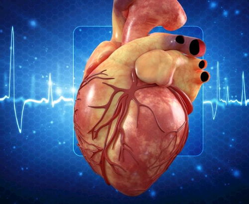 有高血压的人,心脏每分钟跳动超过80次,需要控制吗