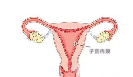 子宫内膜 什么是子宫内膜