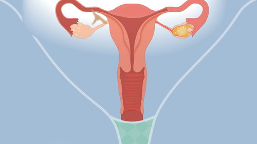 阴道横隔科普视频 权威专家视频解读 健康一线 