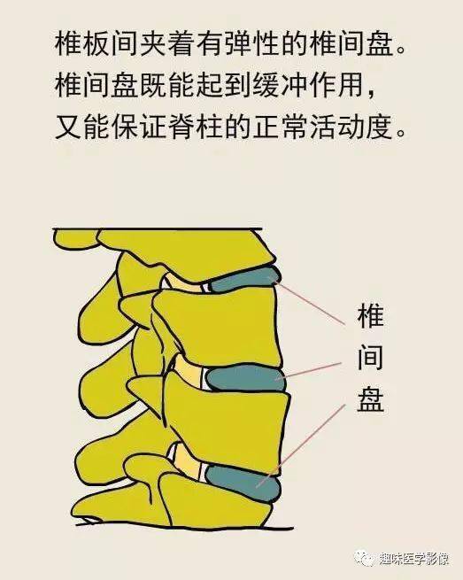 腰椎间盘突出,这样治疗