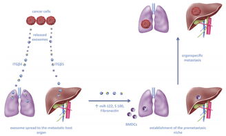 外泌体在肿瘤转移中的作用 