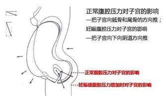 盆底肌损伤应该怎么办 