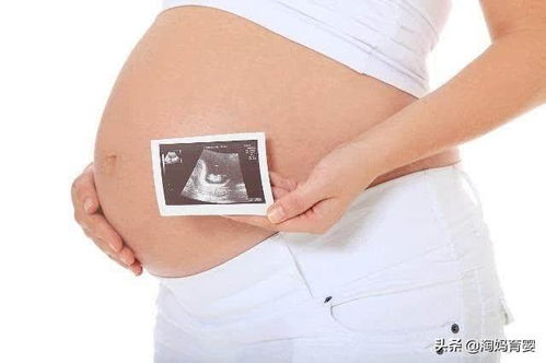 怀孕36周,这3件事孕妇要放在心上,关乎能否顺利分娩