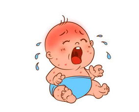 婴儿湿疹膏(宝宝湿疹膏可以往婴儿脸上用吗)