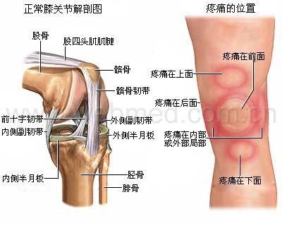 跑步虽好 保护膝盖更重要