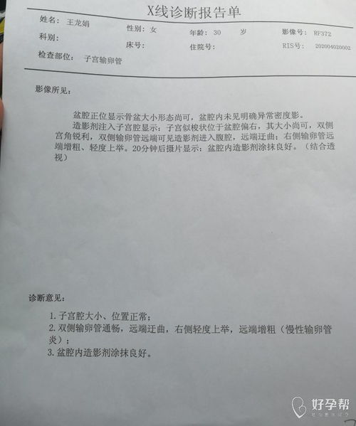 备孕一年多了一直没有怀孕做了各种检查都正常男