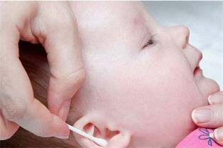 孩子多大可以掏耳朵 如何给宝宝掏耳屎