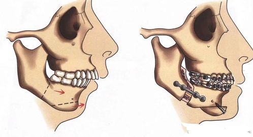 牙颌面畸形的病因