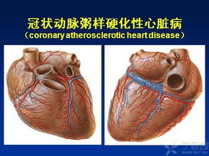 心血管专业必看的30个课件