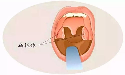 咽壁 文章阅读中心 急不急图文 Jpjww Com