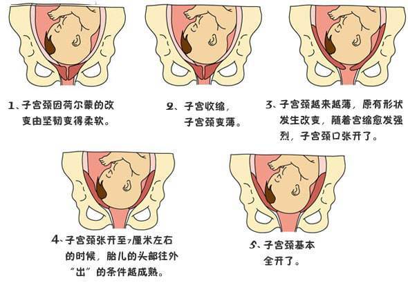 原创孕妇怀孕初期的征兆，腹疼，出血别大意，早知道，早避免，快收藏