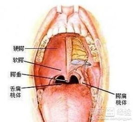 慢性咽喉炎的症状和治疗方法