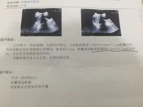 怀孕后想辞职,却被厦门某工厂强制扣留上班13个小时后...流产了