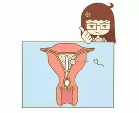 哺乳期避孕(产后哺乳期避孕方法)