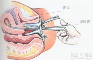 人工流产后可以用那些中药调养身子呢