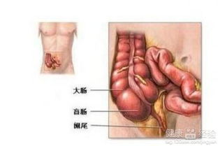 确诊慢性阑尾炎需要做哪些检查