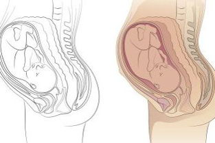 怀孕两个月了,坐飞机通过安检与胎儿有影响吗 安检能扫描出怀孕了吗 